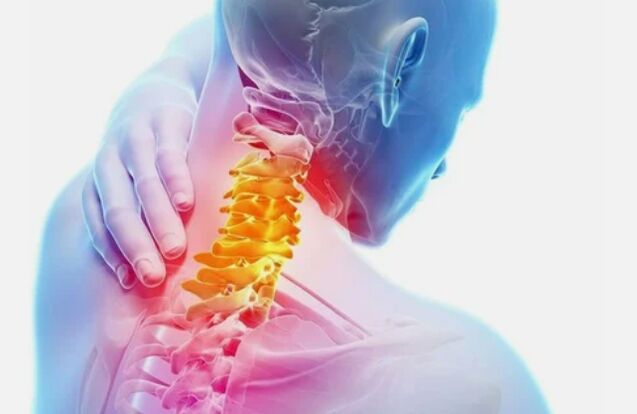 Gimdos kaklelio regiono osteochondrozė