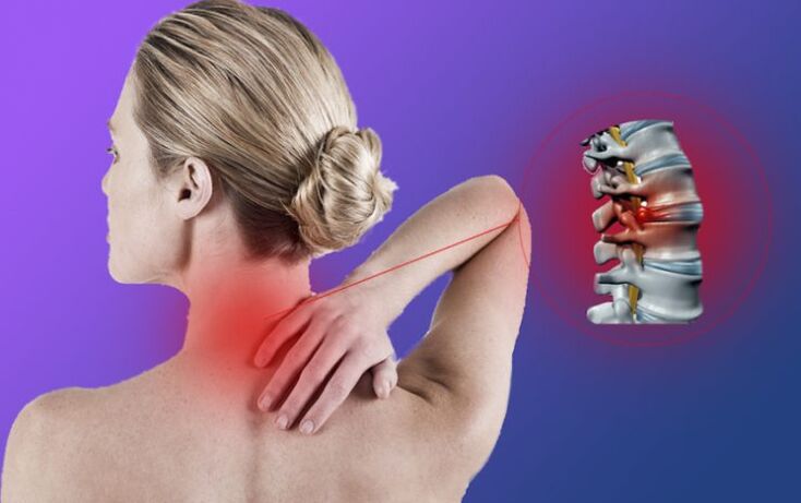 Stuburo uždegimas gimdos kaklelio osteochondroze