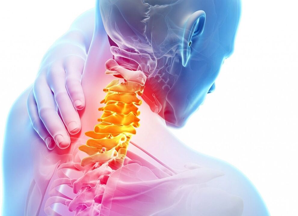 Kas yra gimdos kaklelio osteochondrozė