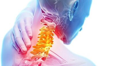 gimdos kaklelio osteochondrozės priežastys