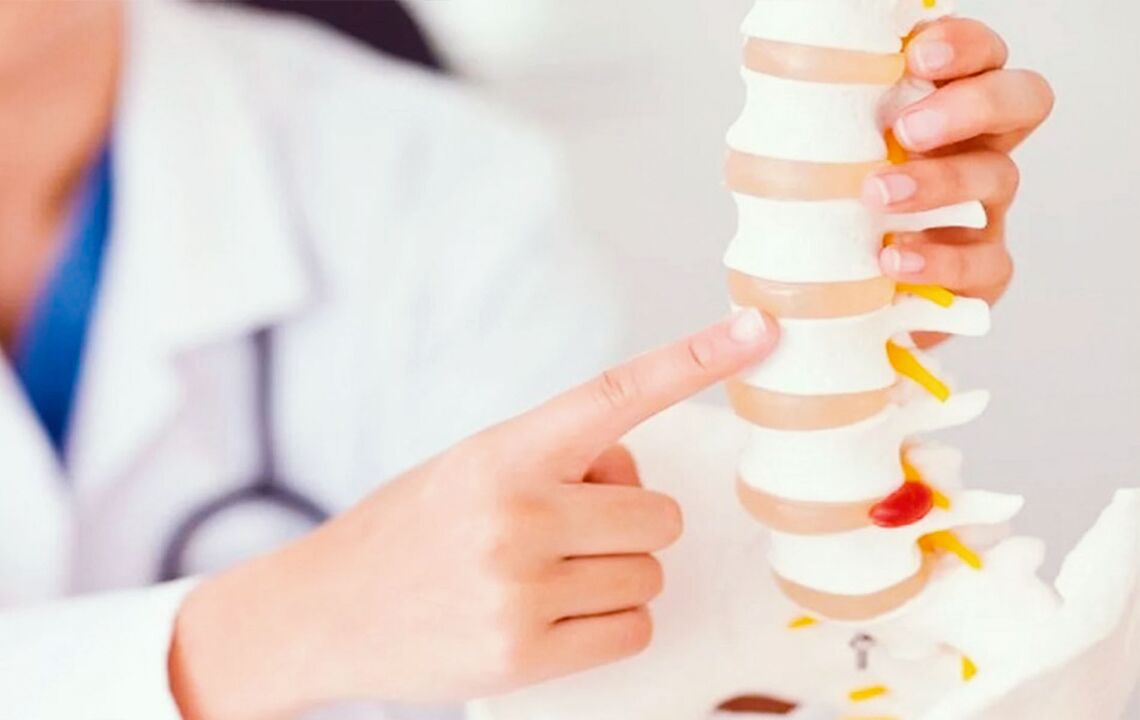 stuburo pažeidimas dėl gimdos kaklelio osteochondrozės