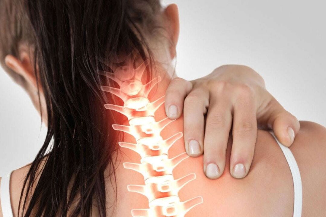 gimdos kaklelio osteochondrozės apraiškos